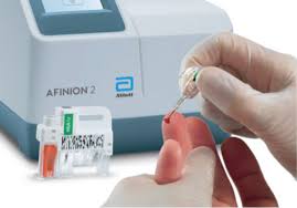 afinion2 The photo shows a white man having a body composition scan in a DEXA scanner. He is lying flat on his back on a raised table as the arm of the scanner passes over his body. There is a logo on the wall behind him that reads My Vital Metrics.