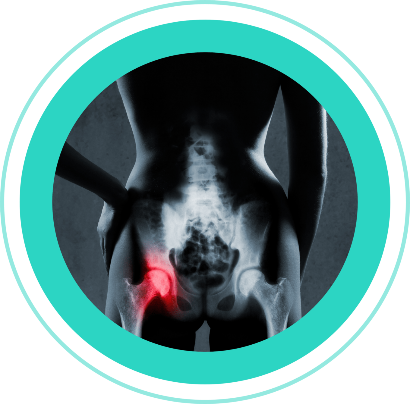 osteoporosis blood testing header The photo shows a white man having a body composition scan in a DEXA scanner. He is lying flat on his back on a raised table as the arm of the scanner passes over his body. There is a logo on the wall behind him that reads My Vital Metrics.